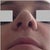 Day 8 - Really uneven nostrils!