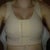 my sexy compression bra i have to wear 24/7 for 6 weeks