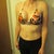 2 weeks post-op!