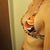 2 weeks post-op, side view