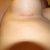 And here's the incision.. not bad at all!!!!