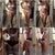 A compilation of views from day 12 po.  Still so swollen in the belly and back but the swelling in the flank area is starting to improve finally.