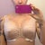 post op day 2-still really swollen and sitting high up on my chest...theyre already very soft though and i lost no nipple sensation during surgery :)