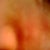 Side bumps of nose