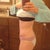 6 weeks postop