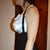 Day after my surgery, all padded up and in my liposuction garment