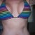 3 weeks post op