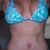 3 weeks post op