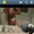 3 days post op without garment