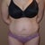 Front view pre-tummy tuck