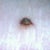 3 weeks after surgery and stitches removed from TT incision and belly button. BB looks normal! Thank goodness!