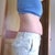 Pre-op muffin top