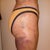 Thighs after 1 week