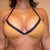 1week after augment and swollen