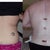 They removed 4 liters during the lipo on my flanks and mons area. Unbelievable.