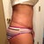 Swelling is subsiding on my flanks, so my stretch marks' swellings going down as well. Yay! My booty's looking good too! Nice and jiggly.