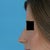 Before -  left profile