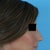 Before - right profile