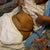 Day of surgery markings. I think this is where things went wrong. Not enough discussion here at all.