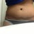 9 mos I'm tilting a little to one side. Thats why I'm a little uneven on the hips.