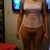 8/30 10 days post op with board (no side foams today)