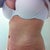 5 months PO  : (