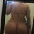 3 weeks post-op...I'm hoping my back smooths out as swelling goes down.