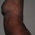 6 weeks post-op