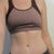 3 months post op