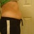 Before...side view