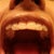 With Aligners in. I have a lot of attachments but I don't even notice them myself really. I like them. Better than metal.