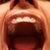 more of bottom teeth.with trays.