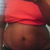 My tummy one week before surgery.  UGLY!!