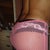 here you can see some fat in the lower back