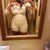 Compression garment/ after picture