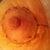 right nipple 10 days out