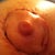left nipple 10 days out