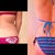 Back 05/19/2013 Before and After