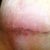 Week 4 close up of stomach incision