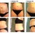 Comparison: 4 Days Before TT > 2 WK PO > 3 WK PO.