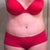 Day 19- suprised to find a little shape to my waist but look at my swollen vajayjay. Everything below bb is a swollen mess