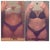 7wks vs 18wks....I have a large amount of gauze hidden on my left side but my right side still swells