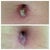 Before after I went to PS- yuck bb