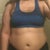 Night before lipo