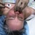 Injecting fat into my mouth area!
