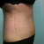 5wks side