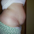 Night Before surgery. 
I can't believe Im showing this!!!