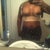 Day 1 post op