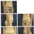 Tummy Tuck before