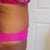 9 wks post op